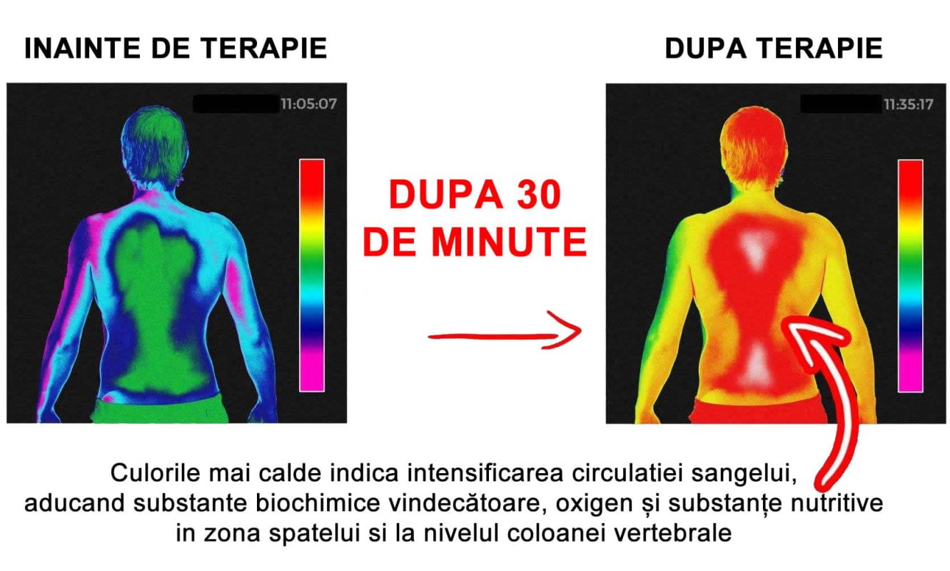 Efectele terapiei cu raze infraroșii_JAD Wellness