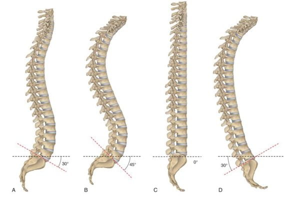 Elongația mecanică a coloanei vertebrale